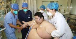 Em 5 meses de quarentena, chinês ganha 101 quilos e é internado