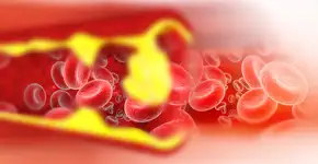 Fruta que reduz o colesterol LDL e ajuda no controle do diabetes