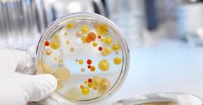 Foto: (iStock/AndreasReh)