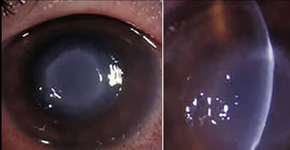 Foto: (reproduçao/CDC)