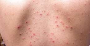 Foto: (Getty Images/iStockphoto)