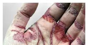 Artista costura a própria mão em obra