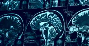 Foto: (iStock/Kondor83)