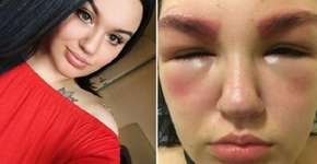 Foto: (Imagem sem texto alternativo disponivel ID [1582174])