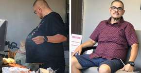 Homem descobre que ‘barriga de cerveja’ era um tumor de 34 quilos