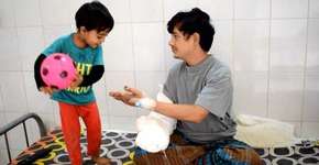 Após passar por 16 cirurgias, ‘homem-árvore’ é curado