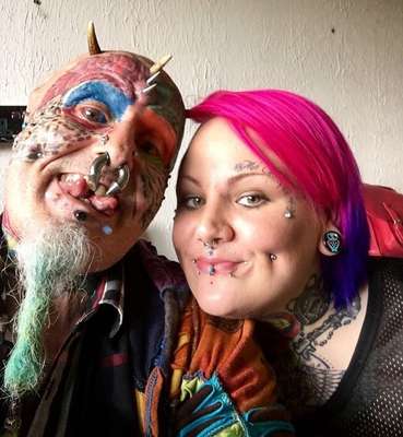 O inglês  mostra o resultado da cirurgia para remover as orelhas (Image: Reprodução/ The Daily Mail) O inglês  mostra o resultado da cirurgia para remover as orelhas (Image: Reprodução/ The Daily Mail) 