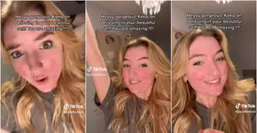 Tiktoker tem conta cancelada por causa de acne