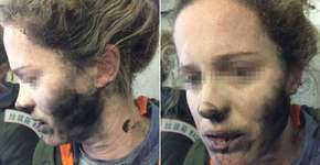 Foto: (Imagem sem texto alternativo disponivel ID [1350035])