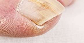 Foto: (zlisjak/istock)