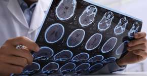 Estudo alerta que baixa libido em homens pode ser sinal de Alzheimer