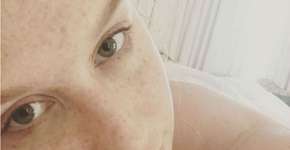 ‘Ofereceram minha liberdade se eu dissesse que nunca fui estuprada’, revela Kesha