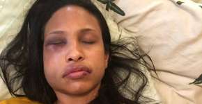 Foto: (reprodução)