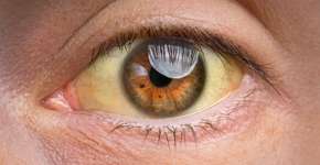 Foto: (Daria Kulkova/istock)