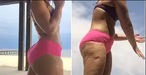 Jovem mostra como fotos podem criar ilusão de corpo perfeito