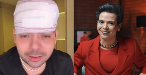 Gustavo Mendes, humorista que imita Dilma, é agredido em MG