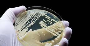 BH tem quatro casos confirmados de superfungo que pode ser fatal