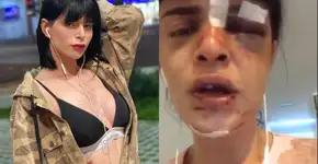 Modelo trans é agredida dentro do próprio apartamento no Rio