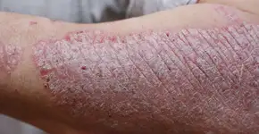 Foto: (andriymedvediuk/depositphotos)