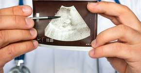 Foto: (Shidlovski/istock)