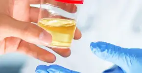 Urina com espuma pode ser problema de saúde