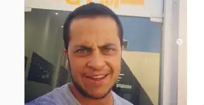 Thammy Miranda fala sobre perda de cabelo: ‘Não me incomoda’