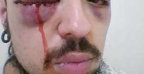 Estudantes acusam policiais por agressão e invasão de propriedade em república universitária