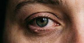 Foto: (Imagem sem texto alternativo disponivel ID [2780641])