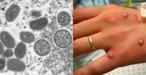 Foto: (reprodução/CDC)