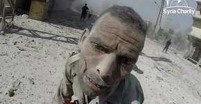 Imagens fortes: vídeo mostra o resgate de feridos após bombardeio