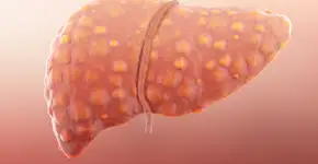 Estudo descobre planta brasileira que reduz gordura no fígado