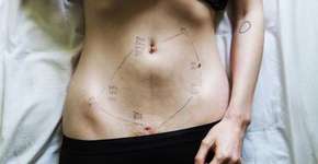 Fotógrafa registra as dores da endometriose em ensaio