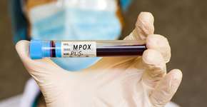 Cepa mais perigosa de mpox já circula fora da África