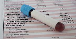 Foto: (iStock/blueshot)