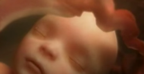 Foto: (Imagem sem texto alternativo disponivel ID [863238])