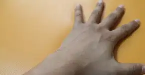 Foto: (Imagem sem texto alternativo disponivel ID [1895522])