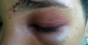 Mulher é agredida após ‘dar fora’ em folião durante o Carnaval