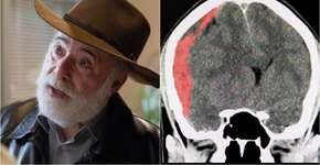 Foto: (Manoella Mello/Globo)