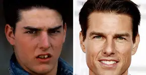 Foto: (Imagem sem texto alternativo disponivel ID [1837968])