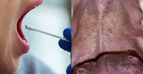 Foto: (Jama Network)