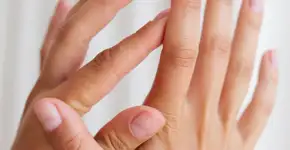 O que significa quando aparecem manchas brancas nas suas unhas?
