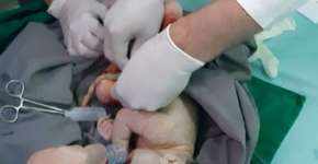 Mulher dá à luz em hospital sem saber que estava grávida