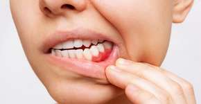 Como a boca pode indicar risco de Alzheimer? Estudo explica!