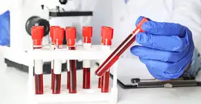 Foto: (Imagem sem texto alternativo disponivel ID [2435480])