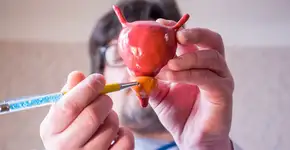 Câncer de próstata: os fatores de risco e como prevenir