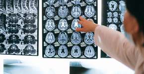 Coleção única: cientista guarda cérebros de até 12 mil anos em busca de respostas