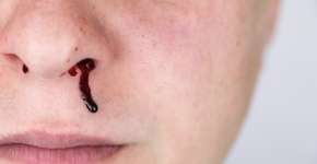 6 sintomas da falta de vitamina K no organismo que são preocupantes