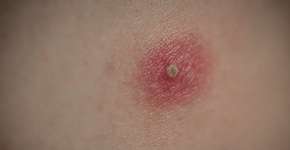 Foto: (Anze Furlan / psgtproductions/istock)