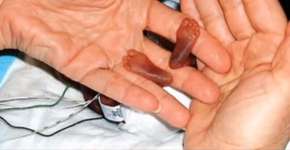 Foto: (Imagem sem texto alternativo disponivel ID [1836514])