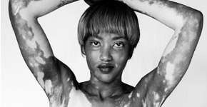 Foto: (Imagem sem texto alternativo disponivel ID [1834463])